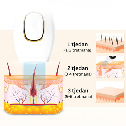 Daynava™ IPL Epilator