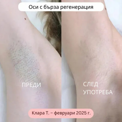 Daynava™ 5 в 1 Електрическа Самобръсначка (BG)