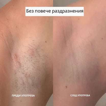 Daynava™ 5 в 1 Електрическа Самобръсначка (BG)