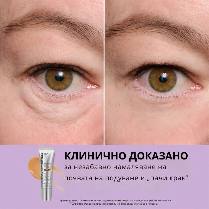 Daynava™ Мигновен Лифтинг за Зоната около Очите