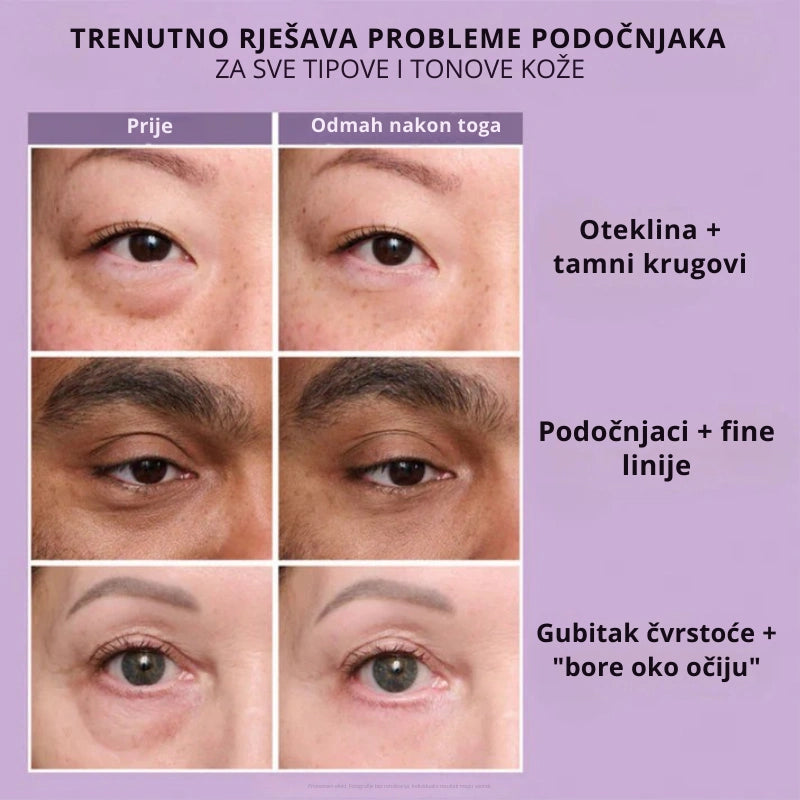 Daynava™ Trenutni Lifter za Oči