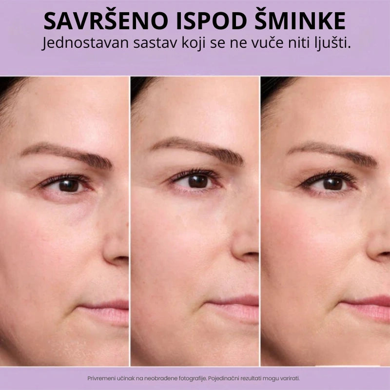 Daynava™ Trenutni Lifter za Oči