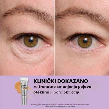 Daynava™ Trenutni Lifter za Oči