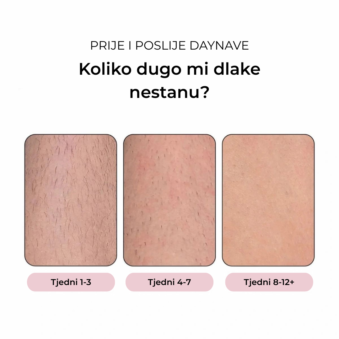 Daynava™ IPL Epilator