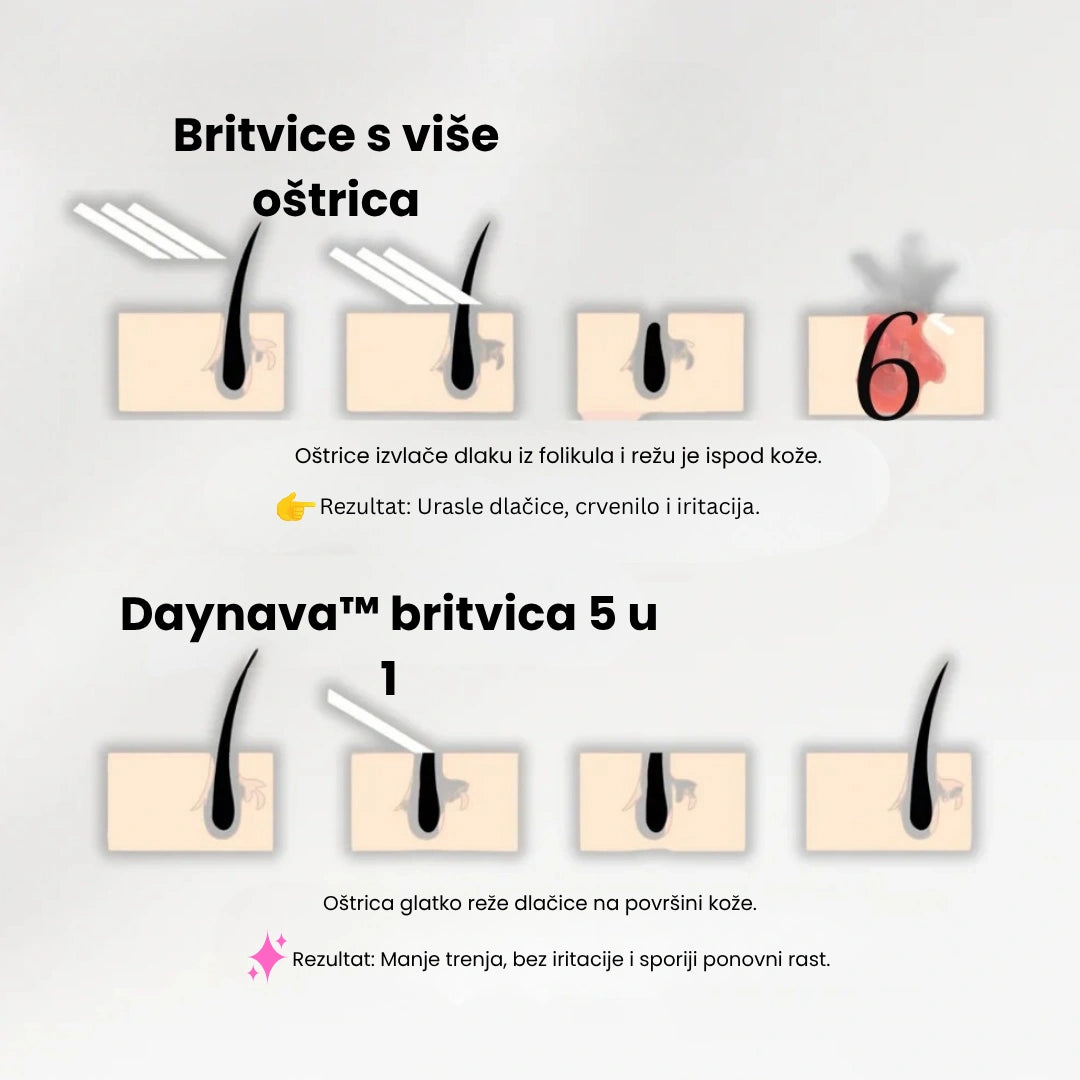 Daynava™ 5u1 Električni Brijaći Aparat