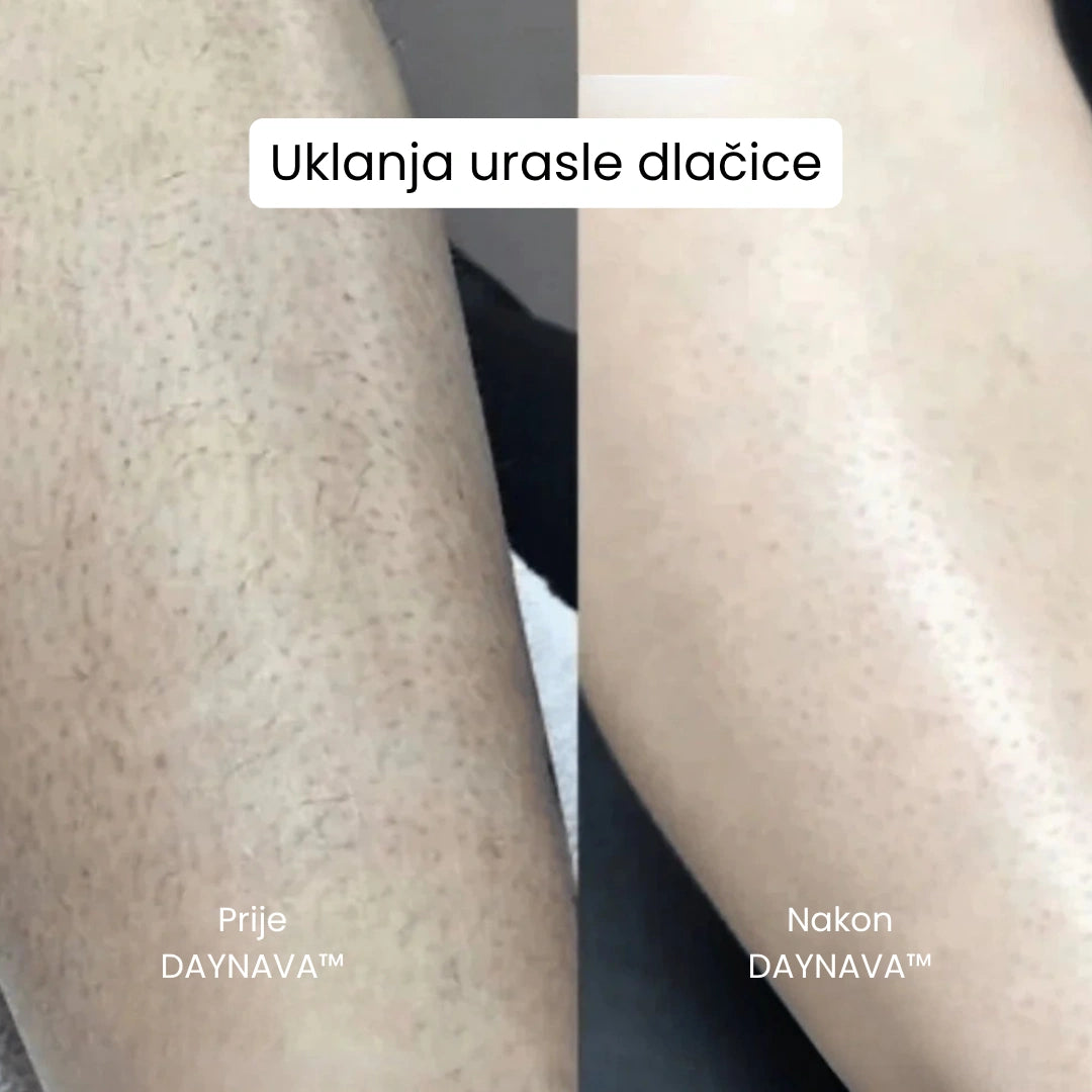 Daynava™ 5u1 Električni Brijaći Aparat