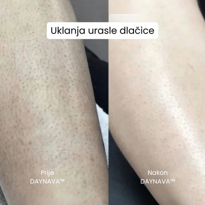 Daynava™ 5u1 Električni Brijaći Aparat