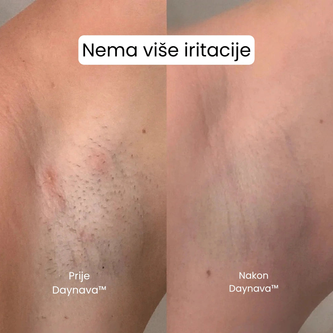 Daynava™ 5u1 Električni Brijaći Aparat