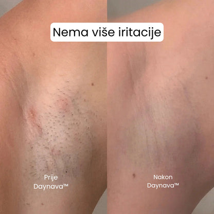 Daynava™ 5u1 Električni Brijaći Aparat