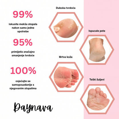 Električna rašpica za stopala Daynava