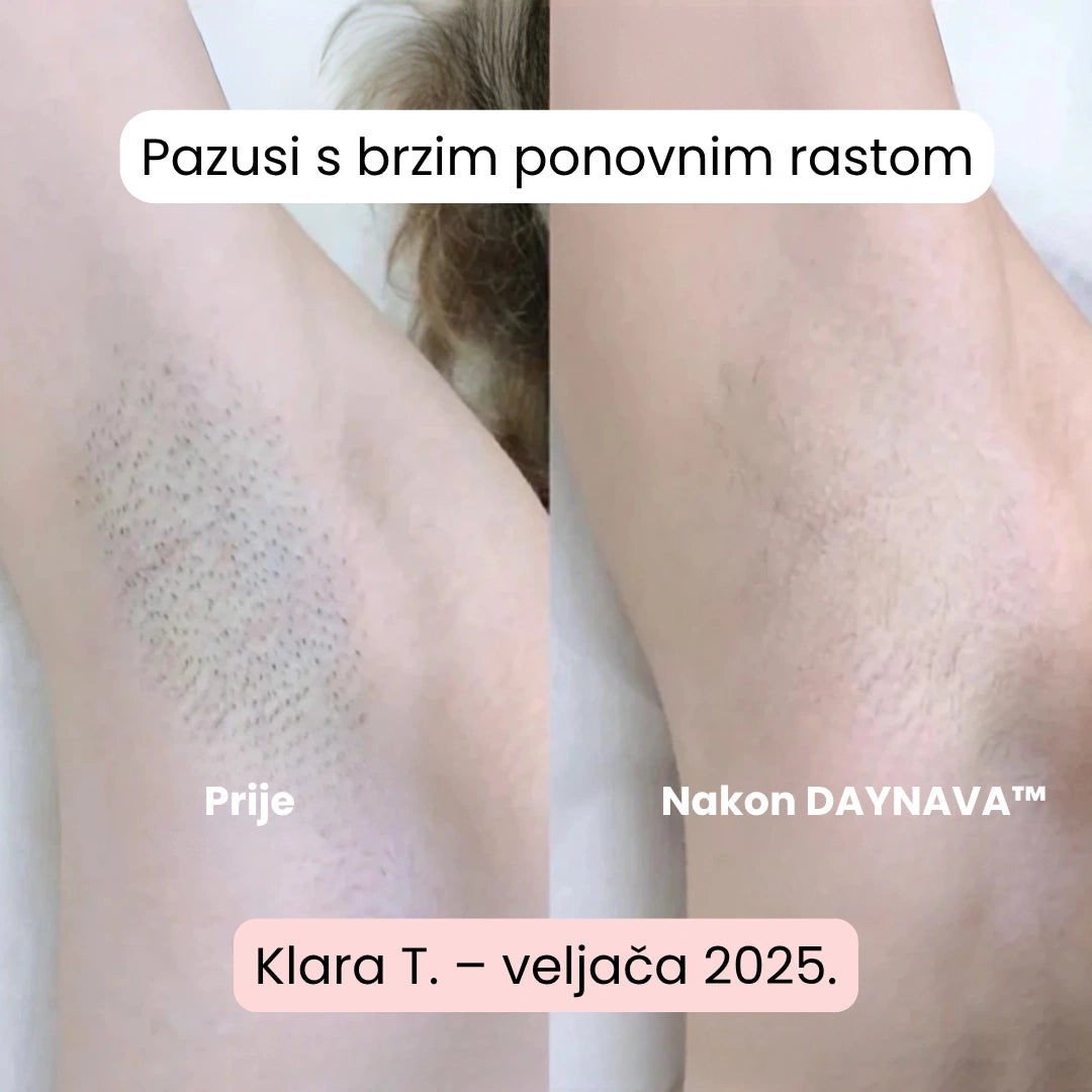 Daynava™ 5u1 Električni Brijaći Aparat