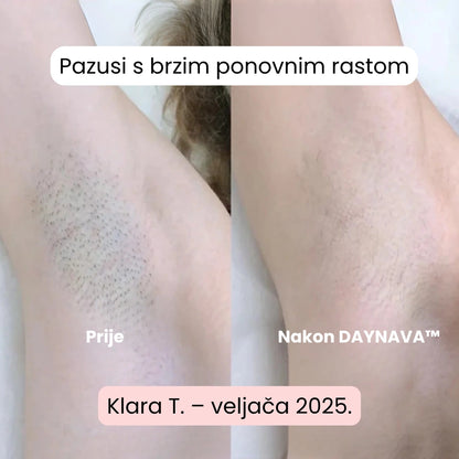 Daynava™ 5u1 Električni Brijaći Aparat