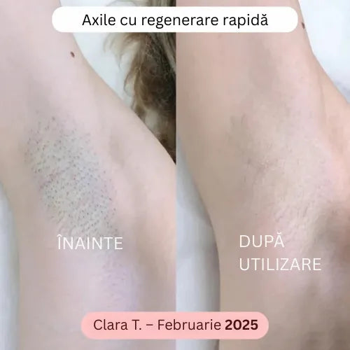 Daynava™ 5 în 1 Aparat de Ras Electric (RO)