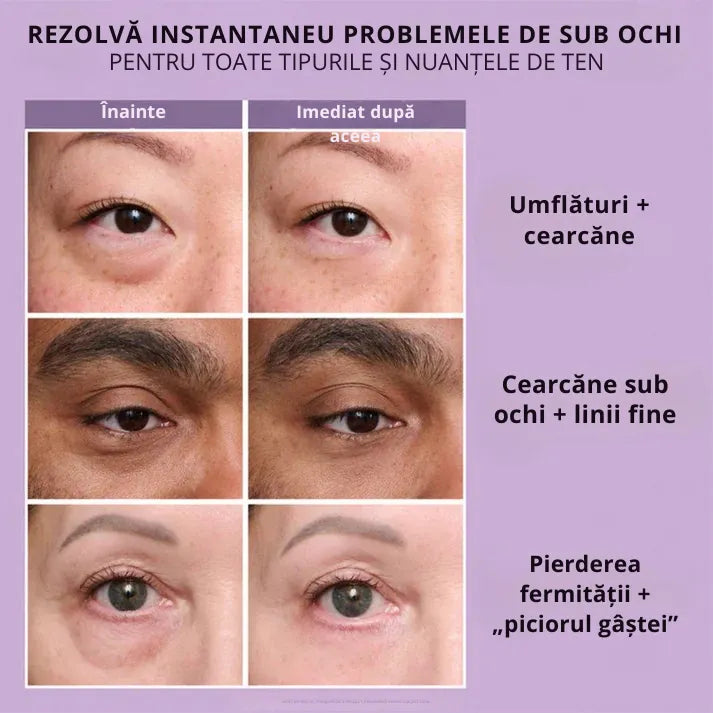 Daynava™ Ridică Instant Zona Ochilor
