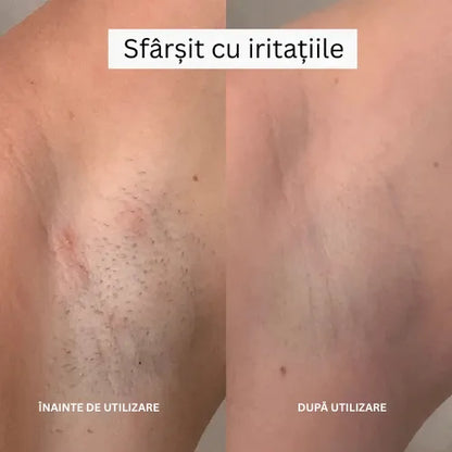 Daynava™ 5 în 1 Aparat de Ras Electric (RO)