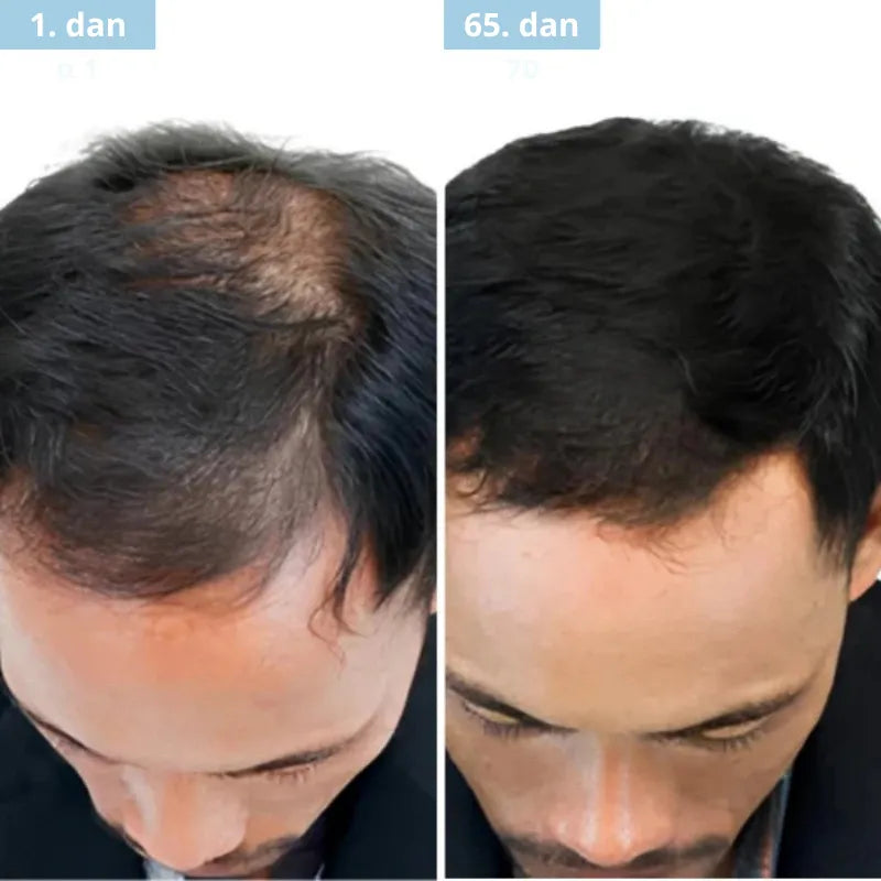 Daynava™ Roll-On za rast las
